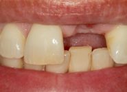 Before - The Queens Dental Practice