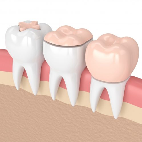 Treatment - The Queens Dental Practice